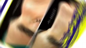 عمل  زیبایی بینی در مشهد