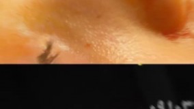 عمل  زیبایی بینی در مشهد