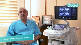 نحوه انجام سونوهیستروگرافی