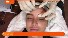 آموزش پاک سازی صورت - آموزش درماپلنینگ