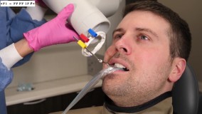 آموزش دستیار دندانپزشک - نحوه گرفتن عکس رادیولوژی دندان