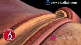 کلسترول چیست؟ چربی خون بالا ، کلسترول بالا ، کلسترول خوب و بد یعنی چه ؟ HDL و LDL چیست؟ ، آزمایش چربی خون ، آزمایشگاه دکتر ریاضی