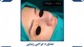 عمل  زیبایی بینی در مشهد
