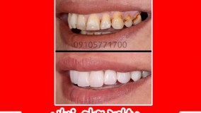 جراحی وزیبایی دندان در مشهد