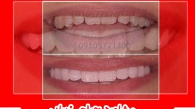 زیبایی دندان در مشهد