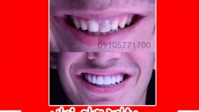 زیبایی دندان در مشهد