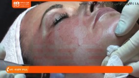 آموزش پاکسازی صورت - آموزش میکرونیدلینگ
