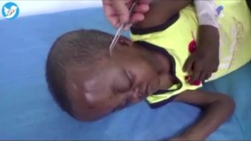 روش عجیب درمان بیماری‌ها با نیش زنبور