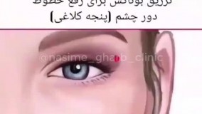 ترین نقاط تزریق ژل و بوتاکس