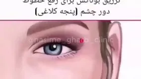 ترین نقاط تزریق ژل و بوتاکس