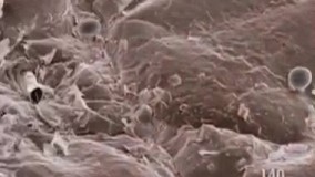 تصویر دست انسان  زیر میکروسکوپ