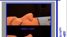 جراحی زیبایی بینی  در مشهد