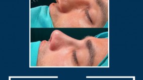 بهترین عمل زیبایی در مشهد