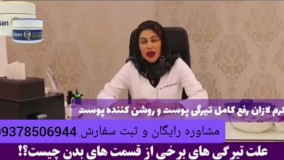 درمان تیرگی شدید پوست