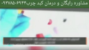 از کبد چرب چه میدانید؟