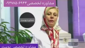 جوش و لک خود را درمان کنید