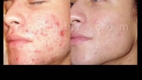 صابون گوگرد چه خواصی دارد؟ /09120132883/صابون گوگرد سپیدک