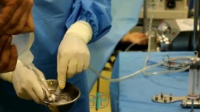 دستگاه لیپوساکشن پزشکی فناوران سپید جامگان