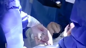 لحظه هیجان‌ انگیز پیوند قلب خوک به انسان