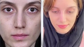 نی نی بان - دکتر سید محمد لاجوردی - بورد تخصصی گوش حلق بینی و جراح سر و گردن