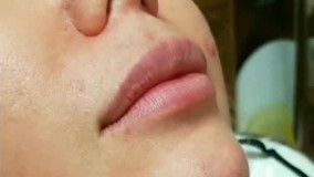 نی نی بان - کلینیک زیبایی لاوین