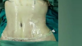 نی نی بان - کلینیک بین المللی آتریسا