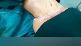 نی نی بان - کلینیک بین المللی آتریسا