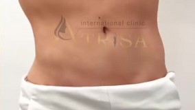 نی نی بان - کلینیک بین المللی آتریسا