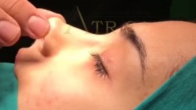 نی نی بان - کلینیک بین المللی آتریسا