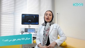 مدت زمان سیکل  IUI