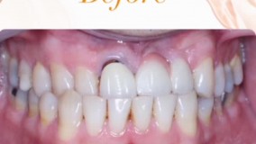 دندانپزشکی تخصصی رویال دنت