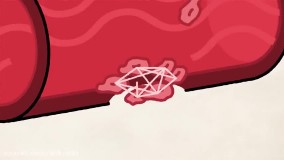 بیماری هموفیلی به زبان ساده! 09044686613 پکیج خارق العاده ژنتیک کنکور