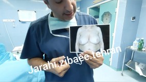 نتایج جراحی زیبایی- دکتر کامران هداوند میرزایی