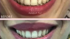 کلینیک زیبایی نلا