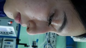 جراحی زیبایی - جراحان زیبایی بهار