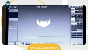 آشنایی با work station دستگاه OPG