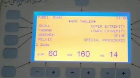 معرفی دستگاه رادیولوژی (رادیوگرافی) جنرال بخش دوم