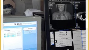 آشنایی با سی تی آنژیوگرافی کاروتید بخش آخر