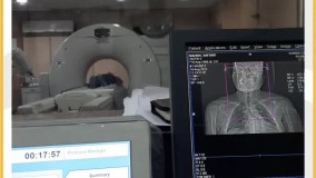 آشنایی با سی تی آنژیوگرافی کاروتید بخش دوم