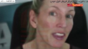 انواع پاکسازی پوست-پاکسازی صورت-نحوه نصب کارتریج سوزن