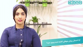 ریزش موهای کاشته شده