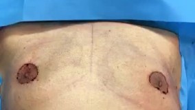 نی نی بان - کلینیک زیبایی لاوین لیپو