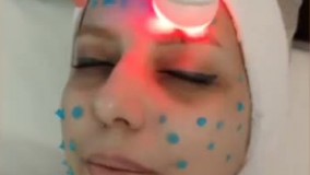 نی نی بان - دکتر بابک رجبلو، متخصص پوست و مو