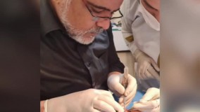 فیلم تغییرات بعد از بلفاروپلاستی - دکتر حمید ملکان راد 09336093000