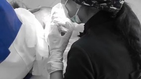 کاشت مو/ کاشت ابرو بدون جراحی  (گرگان گنبد علی آباد )