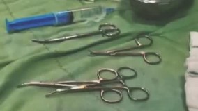 لیفت سینه (ماستوپکسی)، دکتر حمید ملکان راد ، گرگان