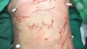 برترین ها - دکتر فرشید مقصودلو