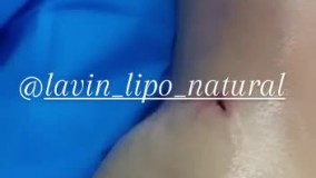 نی نی بان _ کلینیک زیبایی لاوین لیپو