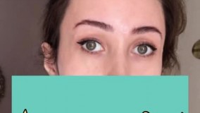 لیفت ابرو اندوسکوپیک