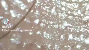 تصاویری از آشيانه ميليون‌ ها ميکروب خطرناک را ببینید